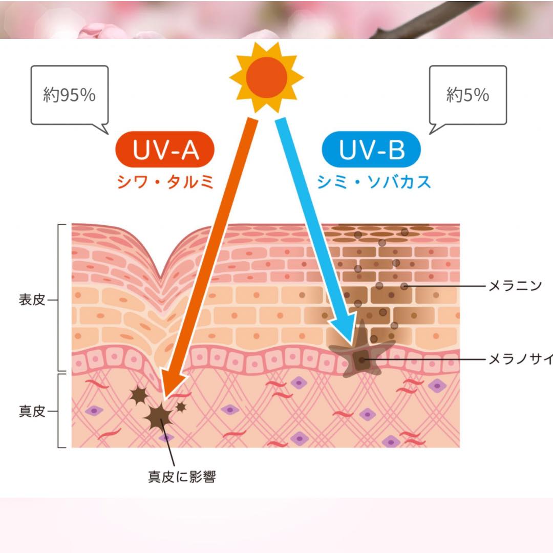 【シワができる原因と対策①】光老化は大丈夫？今からでも遅くないシワ対策とは？