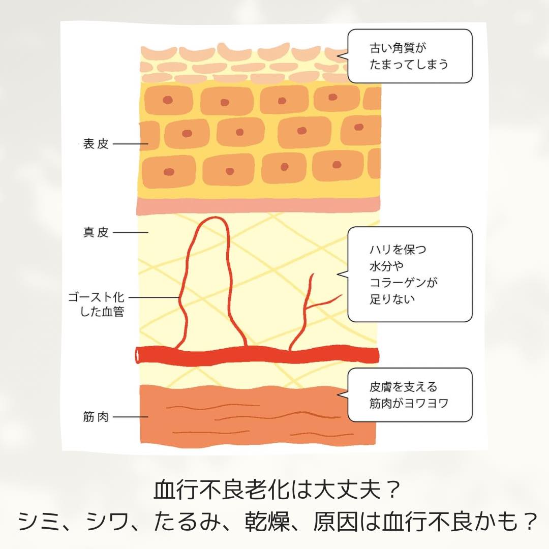 【シワができる原因と対策②】血行不良は大丈夫？今からでも遅くないシワ対策とは？